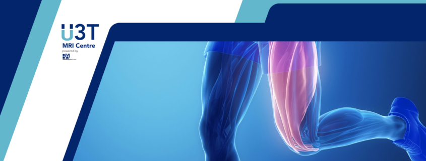 sports injuries - U3T radiology
